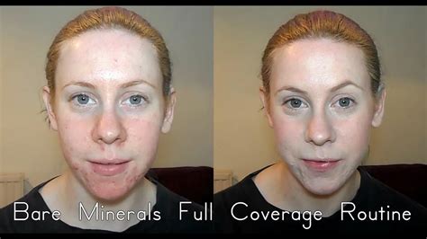 bare minerals makeup for rosacea.